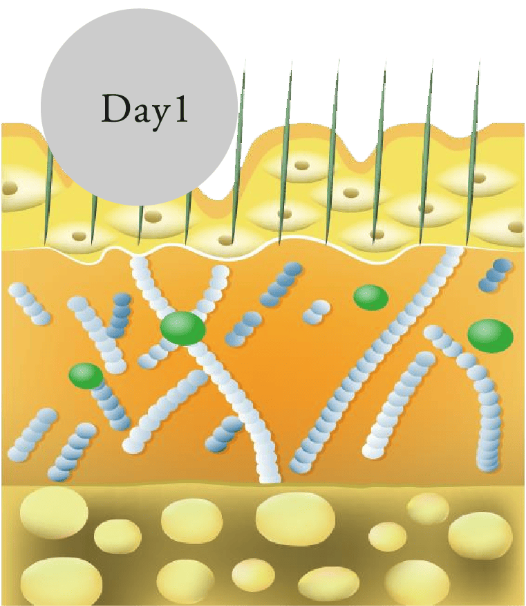 Day1: スピキュールが肌の奥へ浸透するイメージ